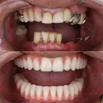 Construction dentaire